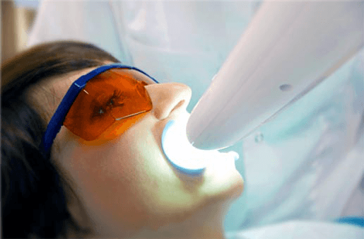 Understanding the Causes of Teeth Sensitivity High-wycombe