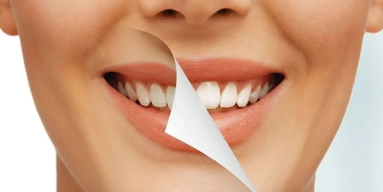 What Is Cosmetic Dentistry and How Can It Transform Your Smile High-wycombe