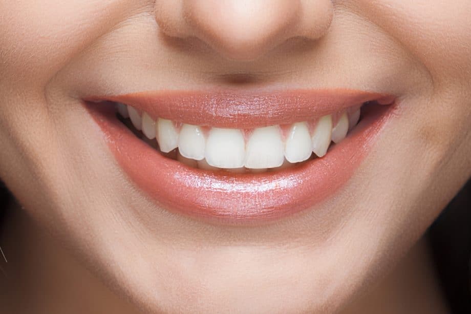 The Role of a Balanced Diet in Long-Term Whitening Results High-wycombe