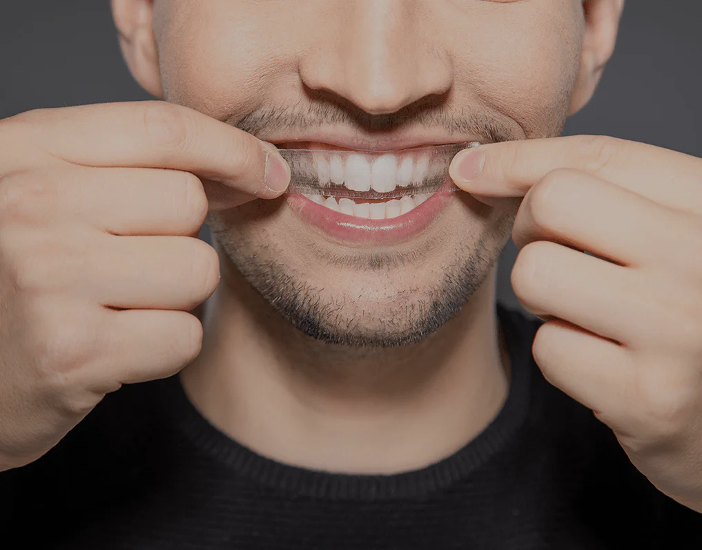 Can You Whiten Natural Teeth Without Harsh Chemicals High-wycombe?