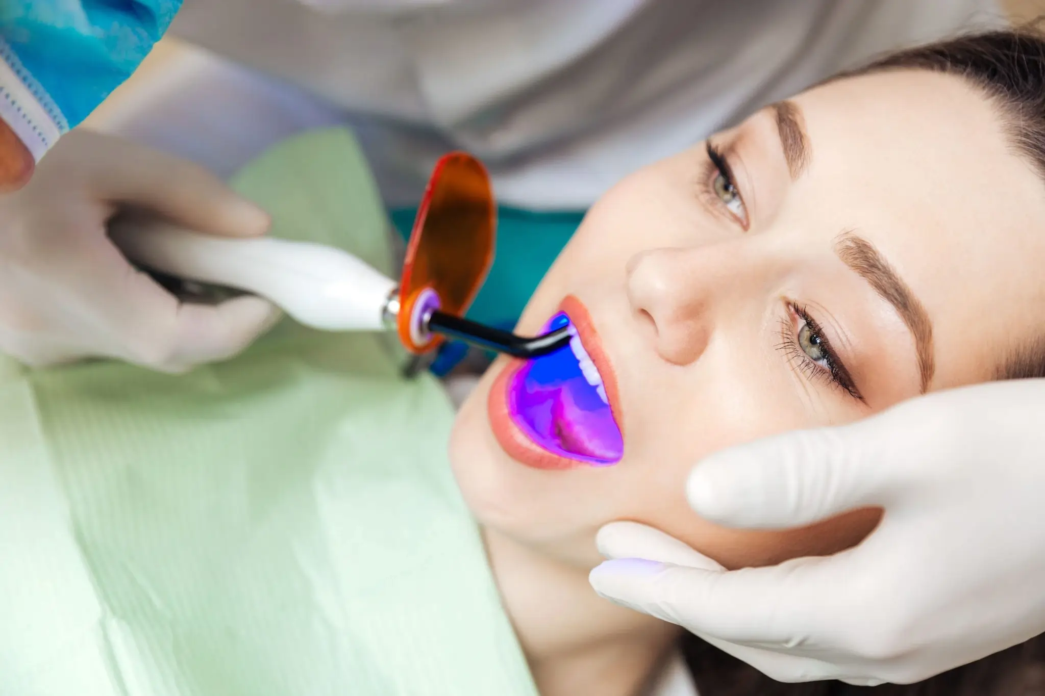 Is Laser Teeth Whitening Safe and Effective High-wycombe?