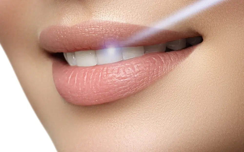 What Are Simple Ways to Improve the Look of Your Smile High-wycombe?