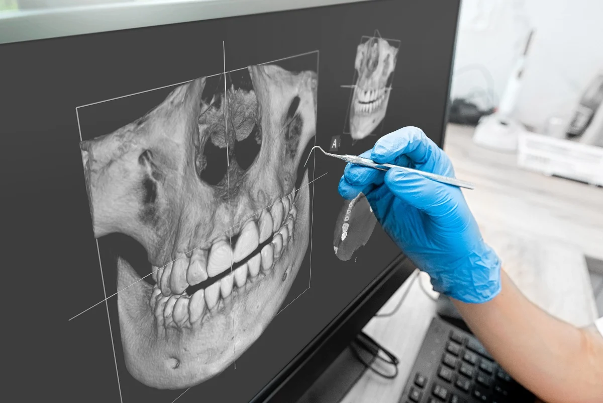 How Is AI Transforming Dental Treatment Planning High-wycombe?