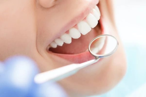 How to Maintain Your Whiter Smile After Treatment High-wycombe