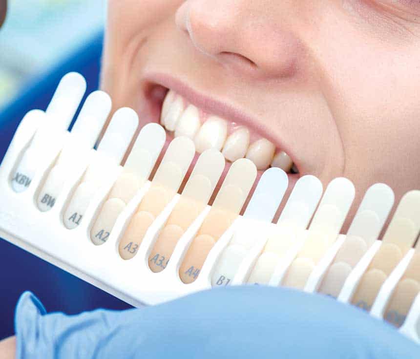 Is Laser Teeth Whitening Worth It for a Brighter, Confident Smile High-wycombe?