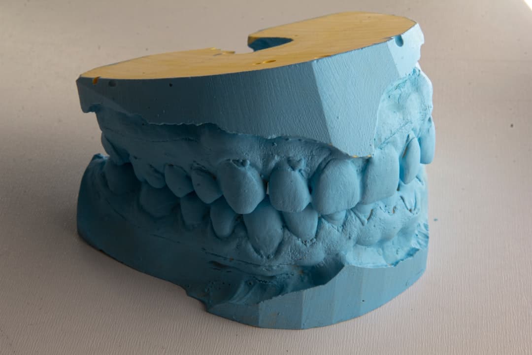 How Do Dental Implants Improve Jawbone Health and Oral Function High-wycombe?