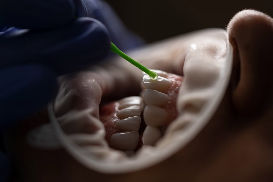 How Saliva Protects Your Teeth and Gums High-wycombe