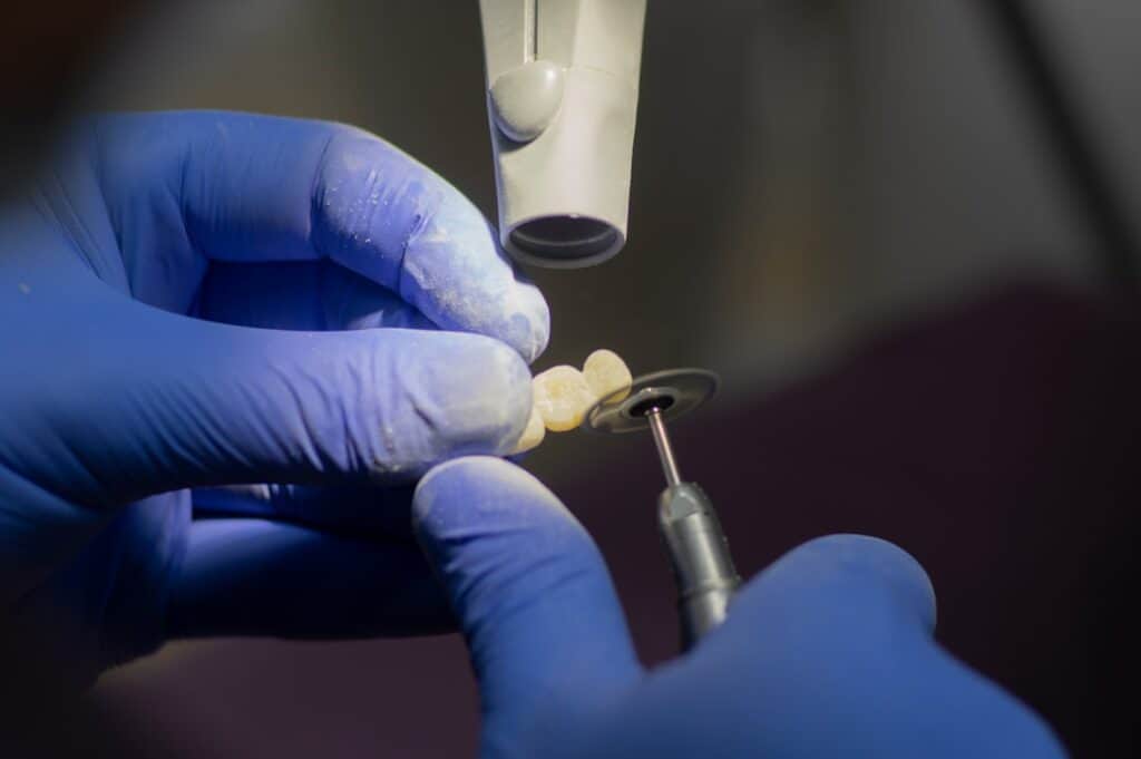 Customised Dental Solutions: Crowns, Aligners, and Implants High-wycombe