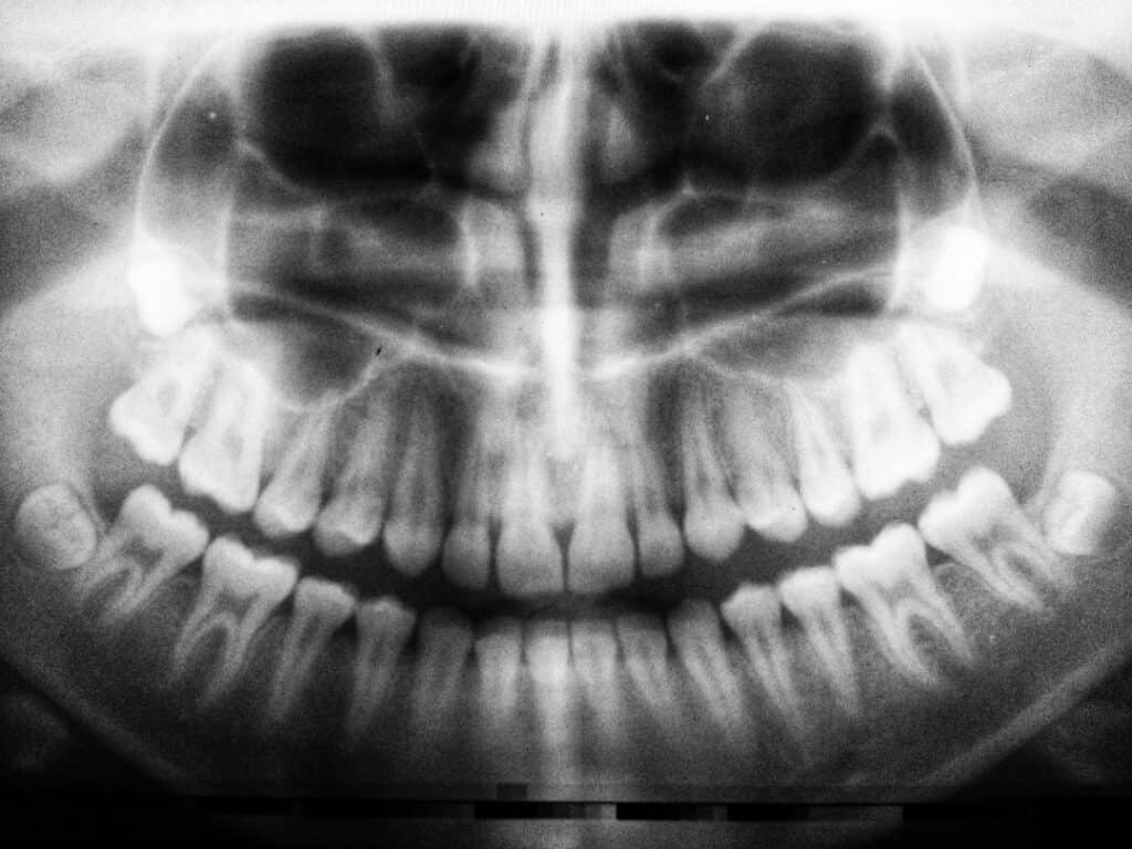 The Future of 3D Printing in Oral Healthcare High-wycombe