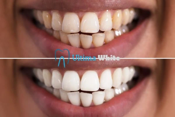 Long lasting results from Ultima White High-wycombe